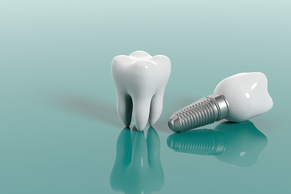 Cosmetic Dental Services Options With Implants from Sai Dental Care in Santa Rosa, CA