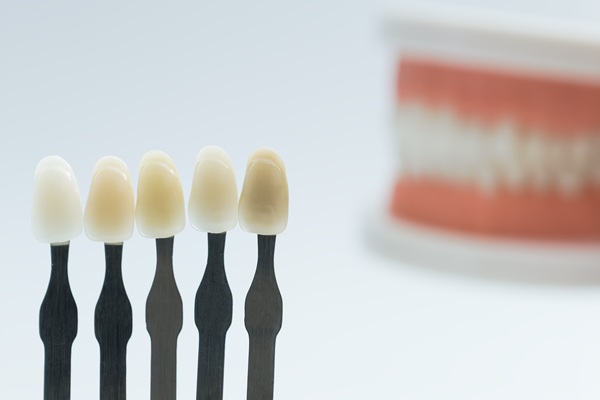 Dental Bonding: An Easy Way To Repair Chips, Cracks, And Gaps