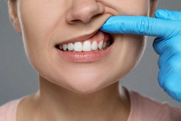 Gum Disease: How To Reverse It And Get Healthy Gums Again