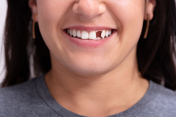 Options for Replacing Missing Teeth With Cosmetic Dental Services from Sai Dental Care in Santa Rosa, CA